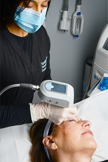 Female patient at the procedure with EXILIS ULTRA