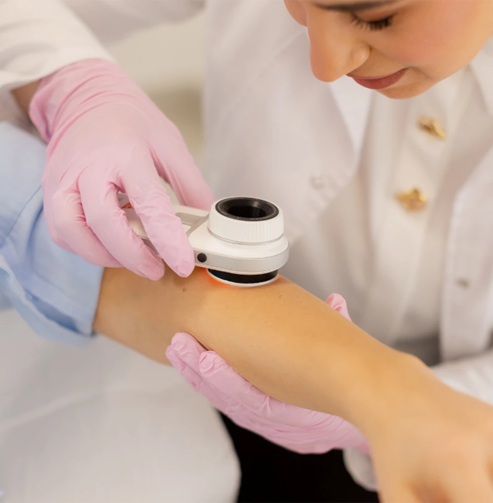 Medical dermatology: Doctor examining patient’s arm with dermatoscope for skin condition