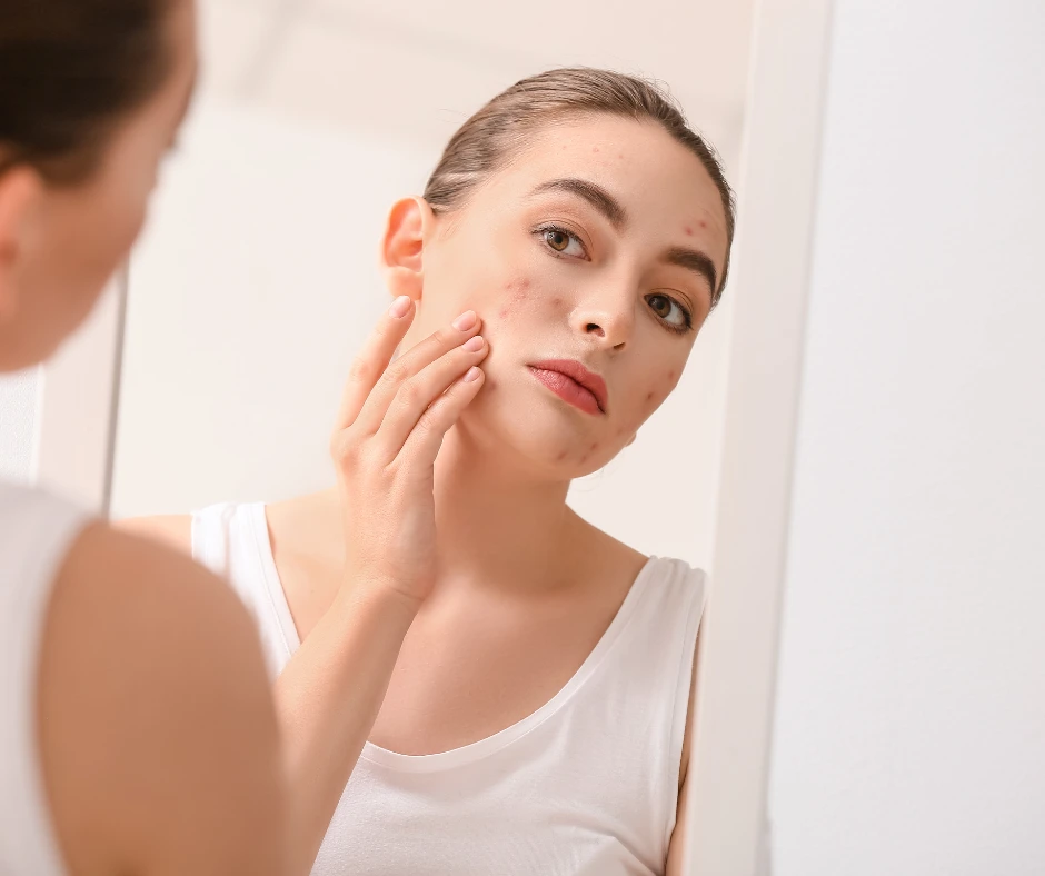 pediatric dermatology-teenager-looking-at-acne-breakout-in-mirror