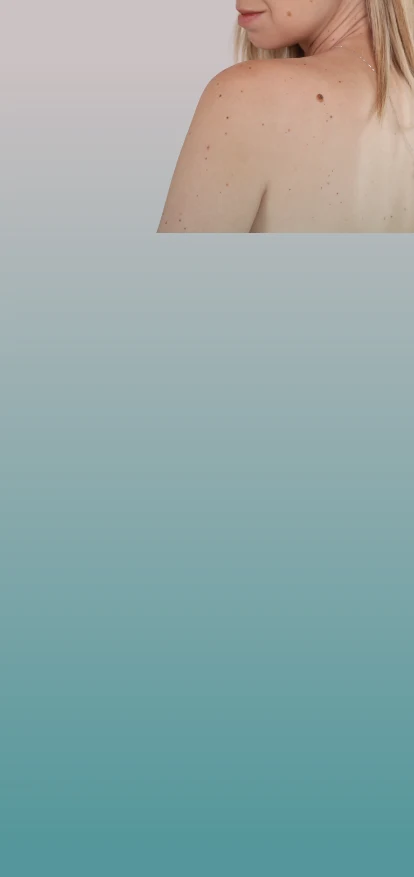  Psoriasis Treatment in Philadelphia Banner