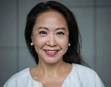 Brow Ptosis vs Eyelid Ptosis: Smiling woman with subtle upper eyelid heaviness
