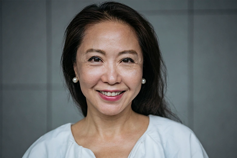 Brow Ptosis vs Eyelid Ptosis: Smiling woman with subtle upper eyelid heaviness